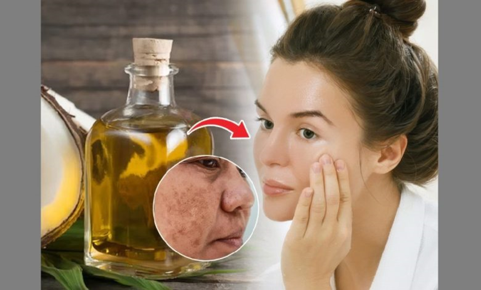 روغن نارگیل و فواید آن برای لک صورت در پامیشا
