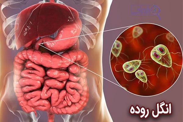 آشنایی با انواع داروهای گیاهی ضد انگلی در پامیشا