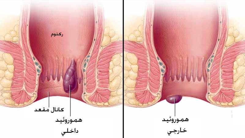آشنایی با خواص درمانی شبدر شیرین 