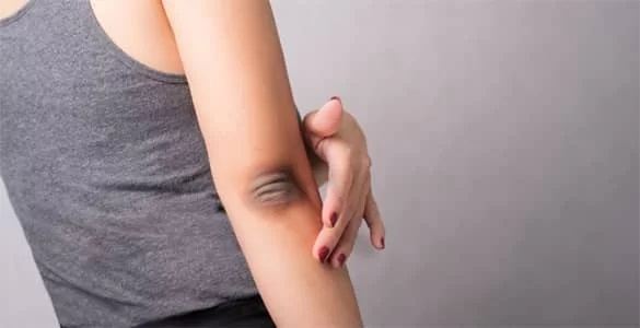  نکات کاربردی برای از بین بردن پینه آرنج  در پامیشا