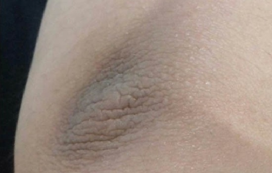 نکات کاربردی برای از بین بردن پینه آرنج در پامیشا