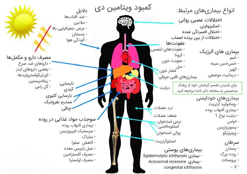 ویتامین D و اطلاعات بیشتر در مورد آن در پامیشا