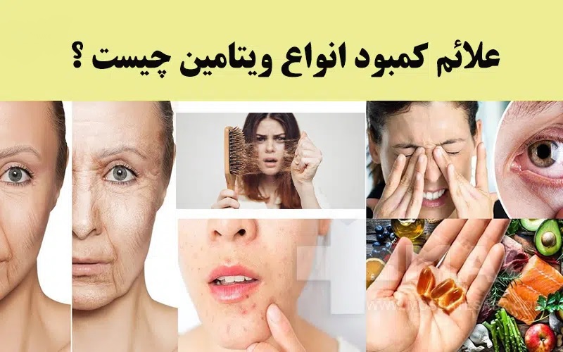 انواع ویتامین K و خواص آنها در پامیشا
