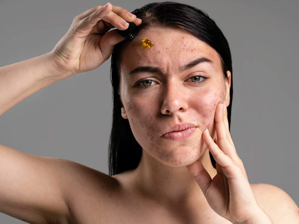 بررسی پوست چرب و مرطوب کننده مناسب آن