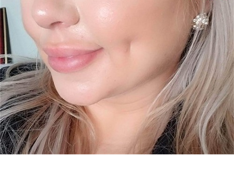 روش ایجاد چال گونه با آرایش در پامیشا