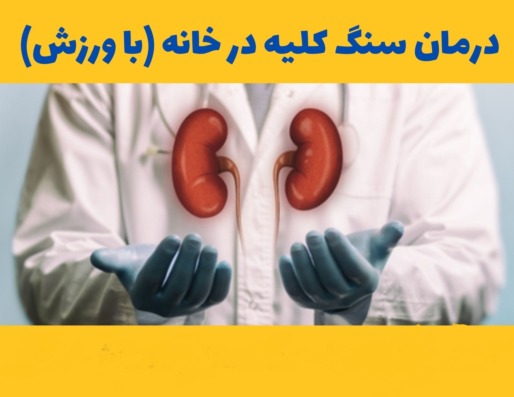 دفع سنگ کلیه با انجام حرکات ورزشی در پامیشا