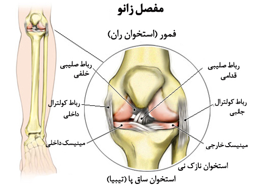 چگونه آسیب مینیسک زانو را درمان کنیم؟ در پامیشا