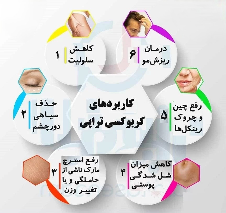  جوانسازی و شفافیت پوست به روش پی آر پی صورت در پامیشا