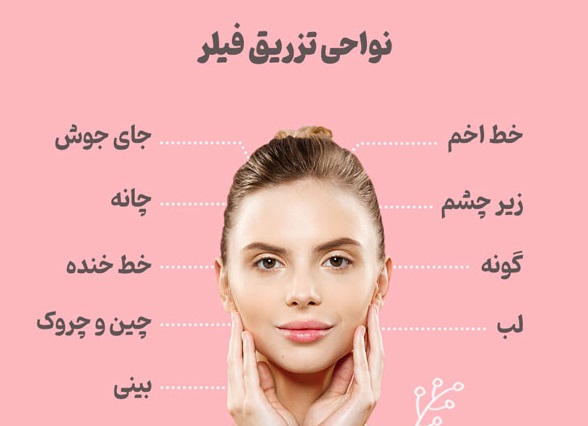 راهنمای انواع تزریق فیلر به صورت در پامیشا