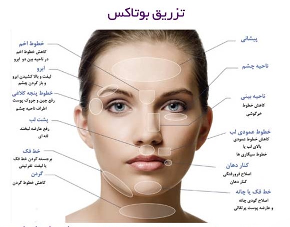  جوانسازی و شفافیت پوست به روش پی آر پی صورت در پامیشا