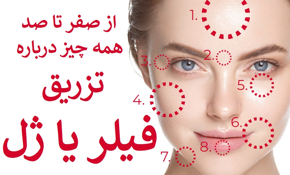 راهنمای انواع تزریق فیلر به صورت در پامیشا
