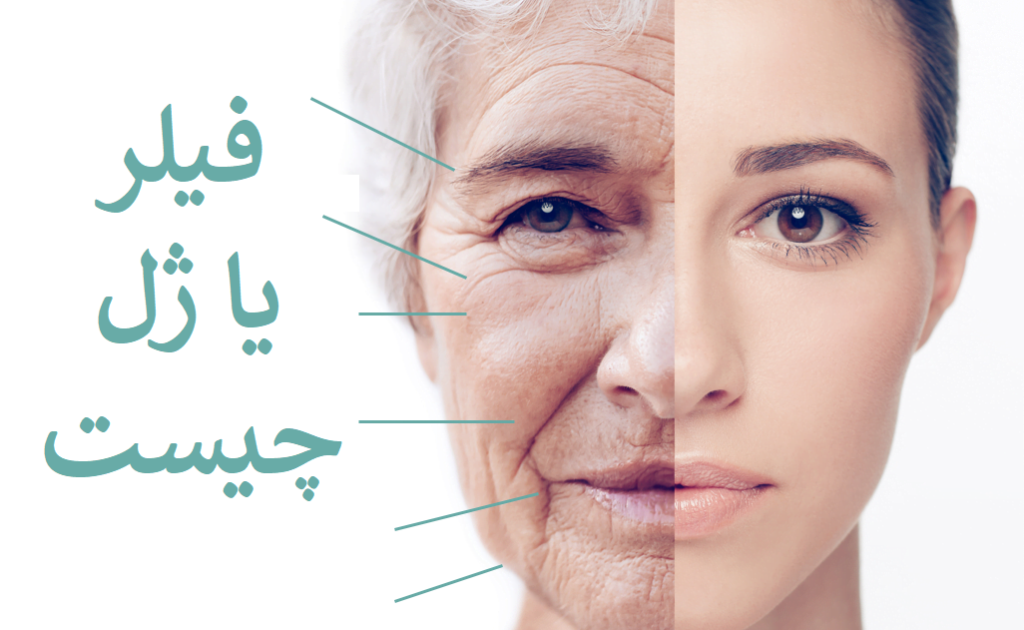 راهنمای انواع تزریق فیلر به صورت در پامیشا