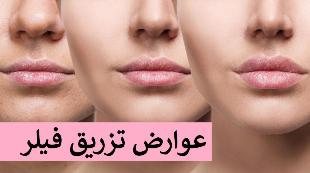راهنمای انواع تزریق فیلر به صورت در پامیشا