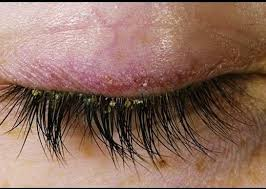 اکستنشن مژه چه تفاوتی با کاشت دارد؟ در پامیشا