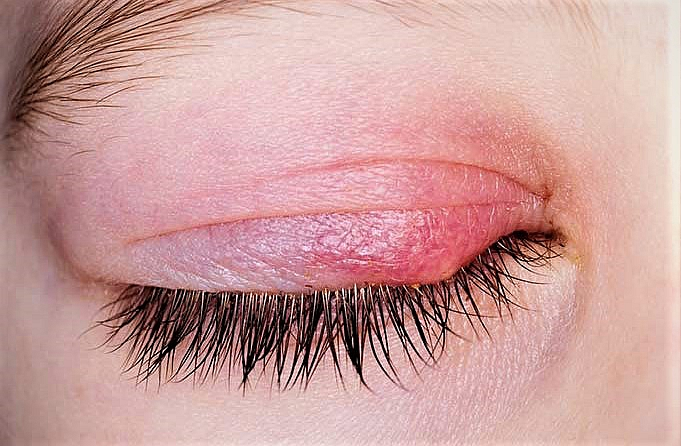 اکستنشن مژه چه تفاوتی با کاشت دارد؟ در پامیشا