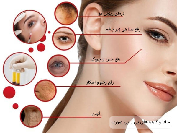جوانسازی و شفافیت پوست به روش پی آر پی صورت در پامیشا