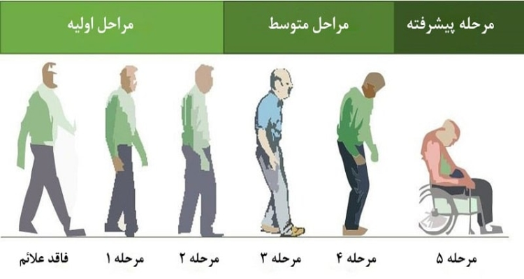 بیماری پارکینسون؛ نشانه‌ها، علائم، پیشگیری و درمان آن در پامیشا