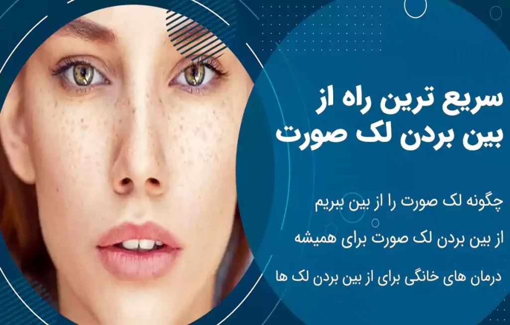 دانستنی های جوش صورت و معرفی درمان های فوری در پامیشا