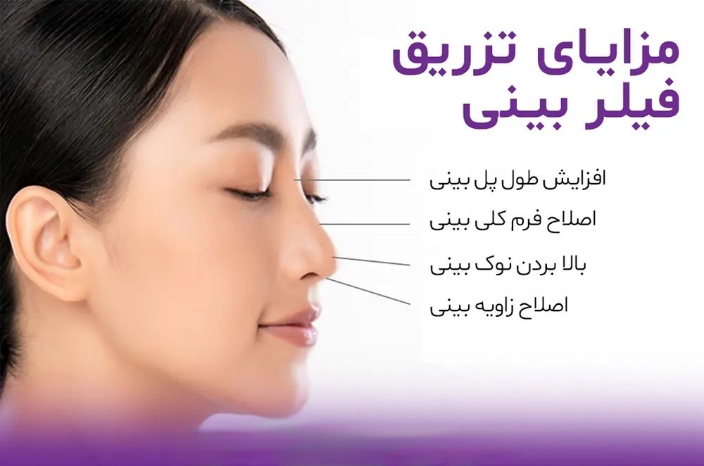 زیبایی بینی و معرفی انواع آن ئر پامیشا