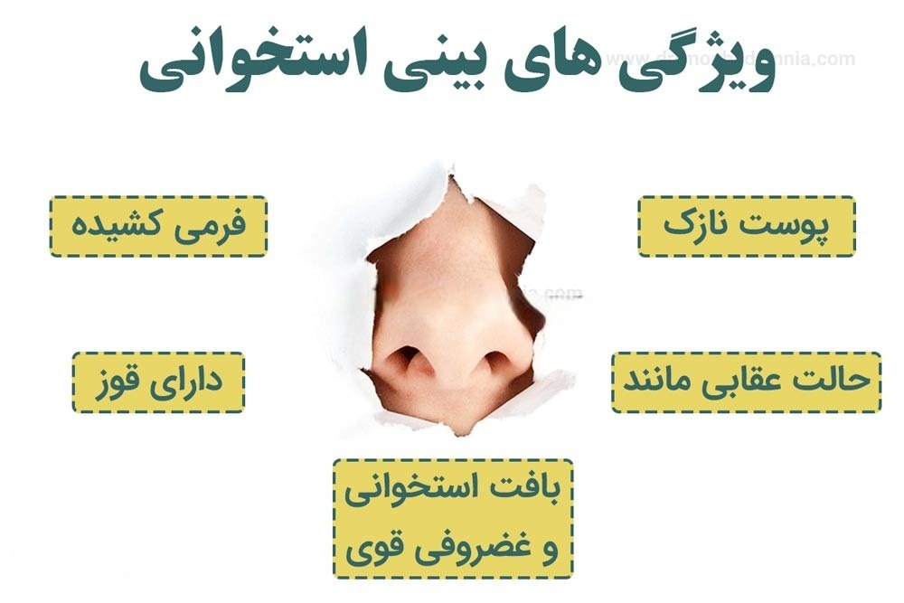 زیبایی بینی و معرفی انواع آن ئر پامیشا