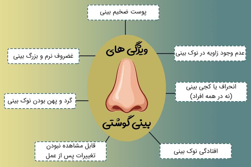 زیبایی بینی و معرفی انواع آن ئر پامیشا