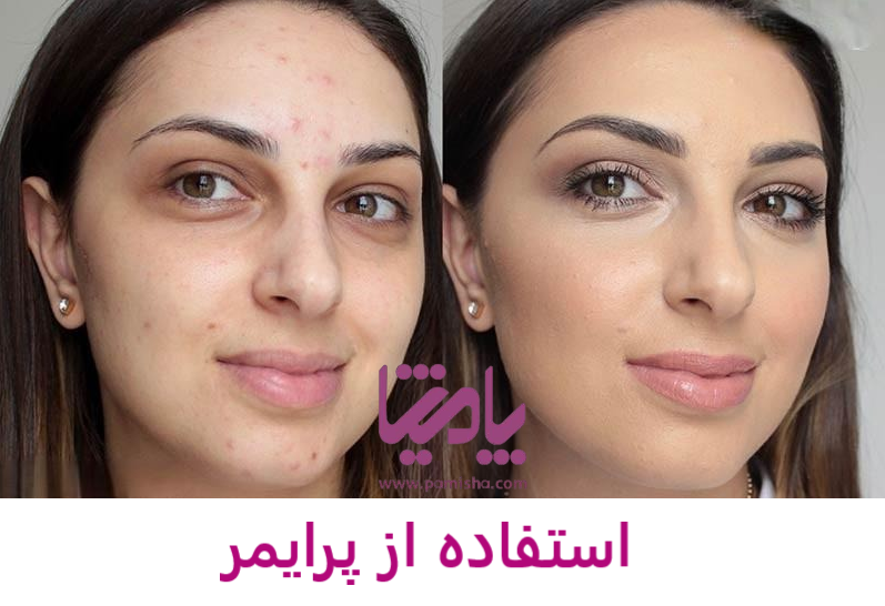استفاده از پرایمر در پامیشا