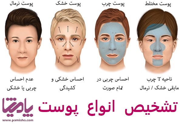 تشخیص انواع پوست در پامیشا