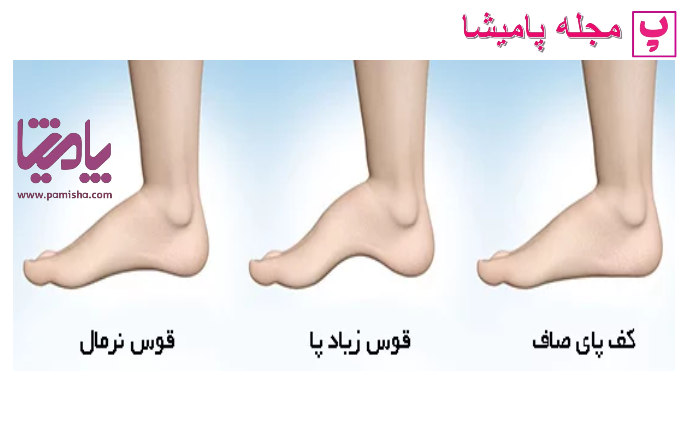 معرفی ساختار پا و سلامت آن ؛ برای مراقبت از پاها چه باید بکنیم؟ در پامیشا