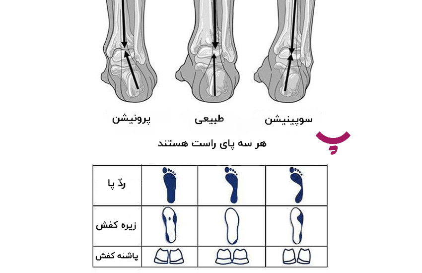 انتخاب کفش مناسب ورزش در پامیشا